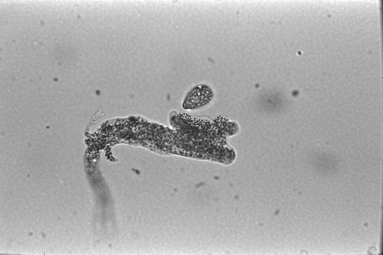 amoeba1.jpg
