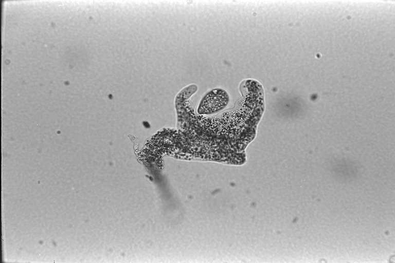 amoeba2.jpg