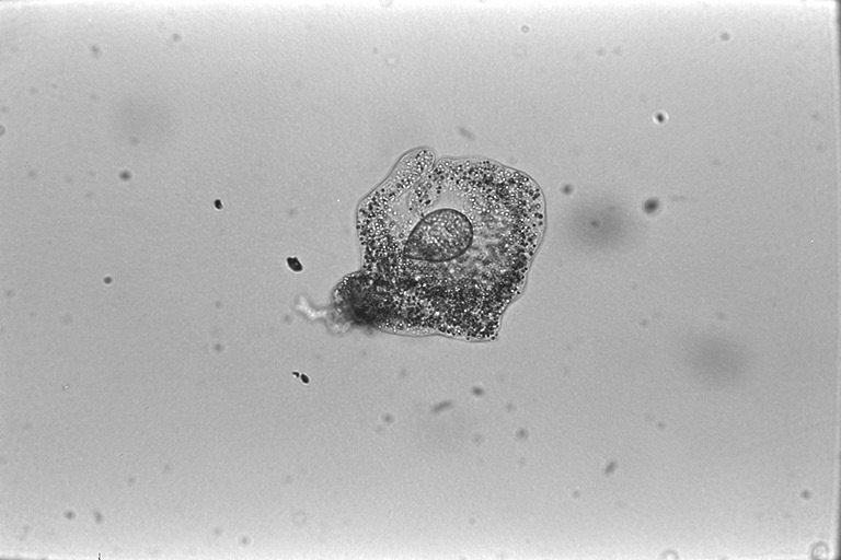 amoeba3.jpg